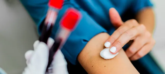 Blood samples after a blood draw