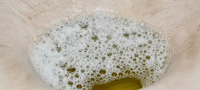Foamy urine