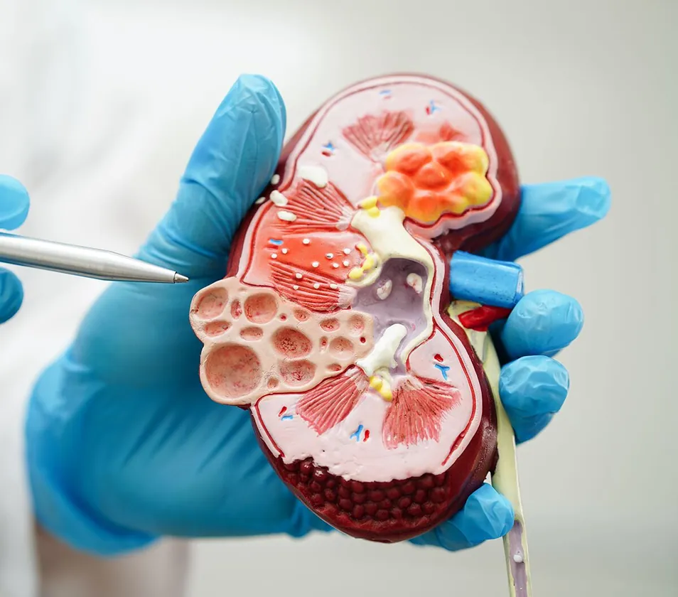 A clinician explaining kidney anatomy with a kidney model